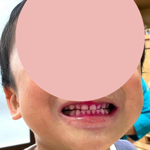 練習1